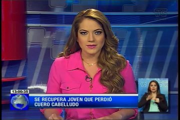 Se recupera joven que perdió cuero cabelludo