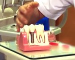 Prof. Dr. Ömer Kutay - Diş implantının bakımı nasıl yapılır?