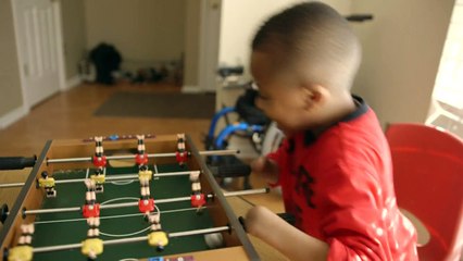 Primer trasplante doble de manos a niño en EEUU