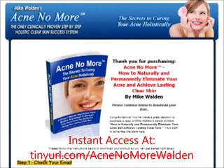 Descargar video: (Review) Acne No More Mike Walden (Acne No More)