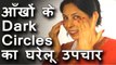 आँखों के dark circles का घरेलू उपचार । Dark circles under eyes home remedy in Hindi