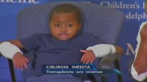 Filadélfia faz primeiro transplante duplo de mãos em uma criança