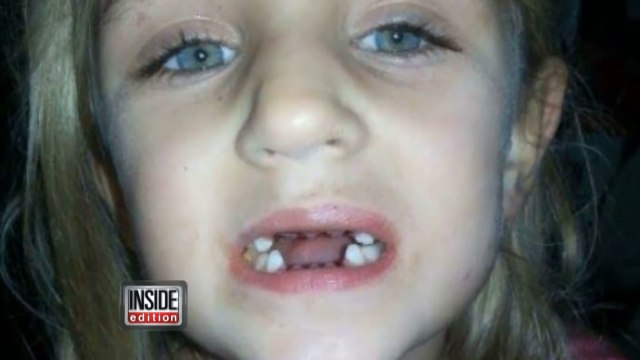 Un dentiste poursuivi par ses patients car il arracher les dents sans raison