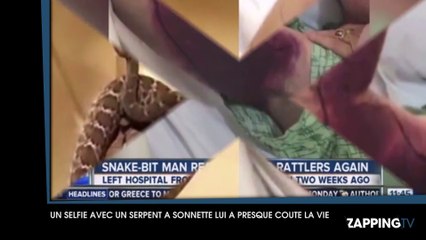 Un selfie avec un serpent venimeux coûte 150 000 dollars de frais médicaux à un Américain !