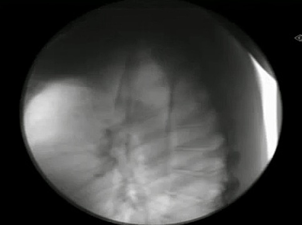 Moving X-ray INSIDE Sword Swallower Swallowing 7 swords on Stan Lee's Superhumans-aMc6-gJJWRA