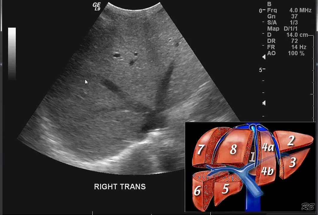 Introduction to the interpretation of Abdominal Ultrasound