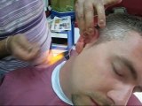 Turkish barber ear hair removal with fire