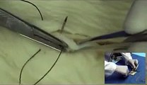 02 Enseñanza de técnicas básicas de sutura en modelos de vísceras animales