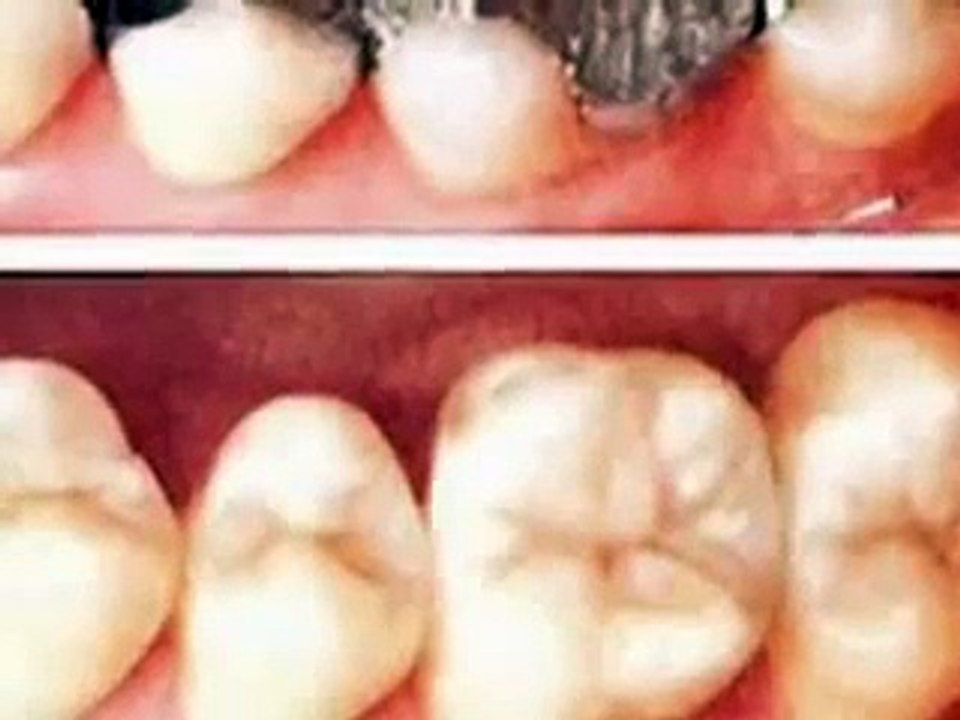 MERCURIO NUESTRA SALUD EN PELIGRO