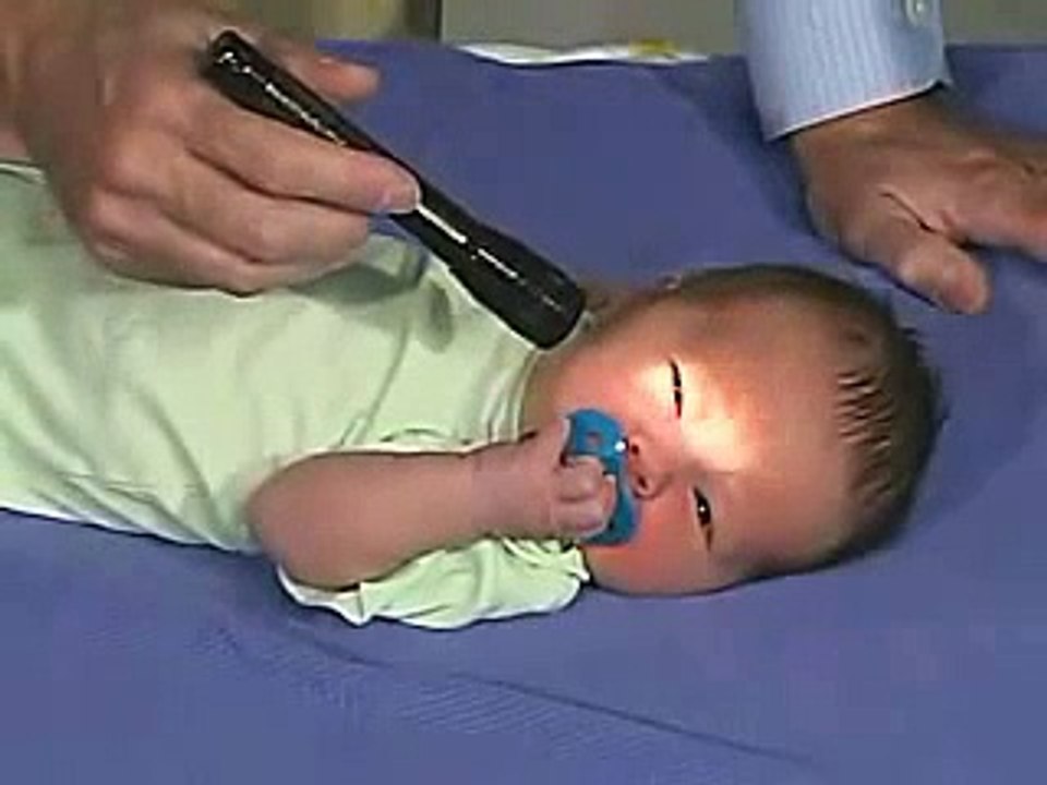 ImedrxTv The Video Blog University of Utah Pediatric Neurological Examination Normal Newborn