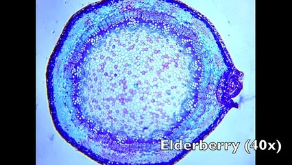 DIY Smartphone Digital Microscope