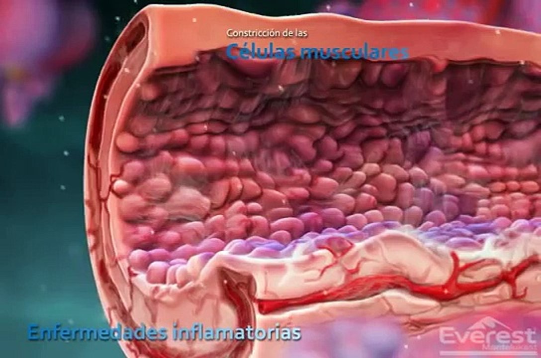 Montelukast Mecanismo de accion