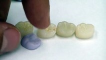 Ceramic and Resin Crowns (What's What)....and how CAD/CAM comes into play..