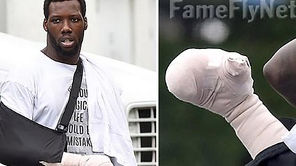 Photos of Jason Pierre-Paul's Hand Post-Fireworks Accident Emerge