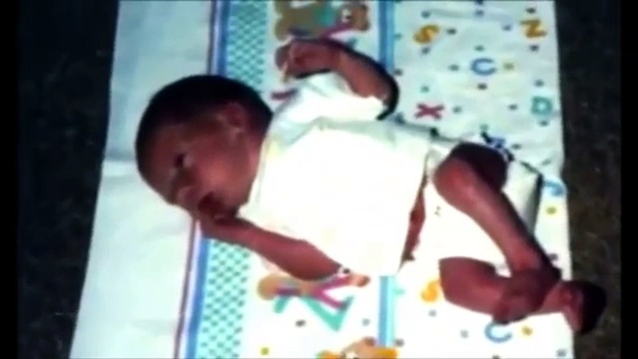 Extraordinary People - Documentary - Common Variable Immunodeficiency Disease (CVID)