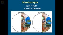 Hemianopia explained and simulated using an eye-tracker