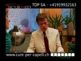 Calvizie, Capelli, metodo Contact Skin, Cure per capelli, Nuove tecnologie, Alopecia
