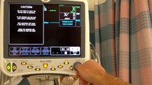 GE Dash 5000 Patient Monitor: COM ports, RS232, and Service Mode (Vitalsguy.com)