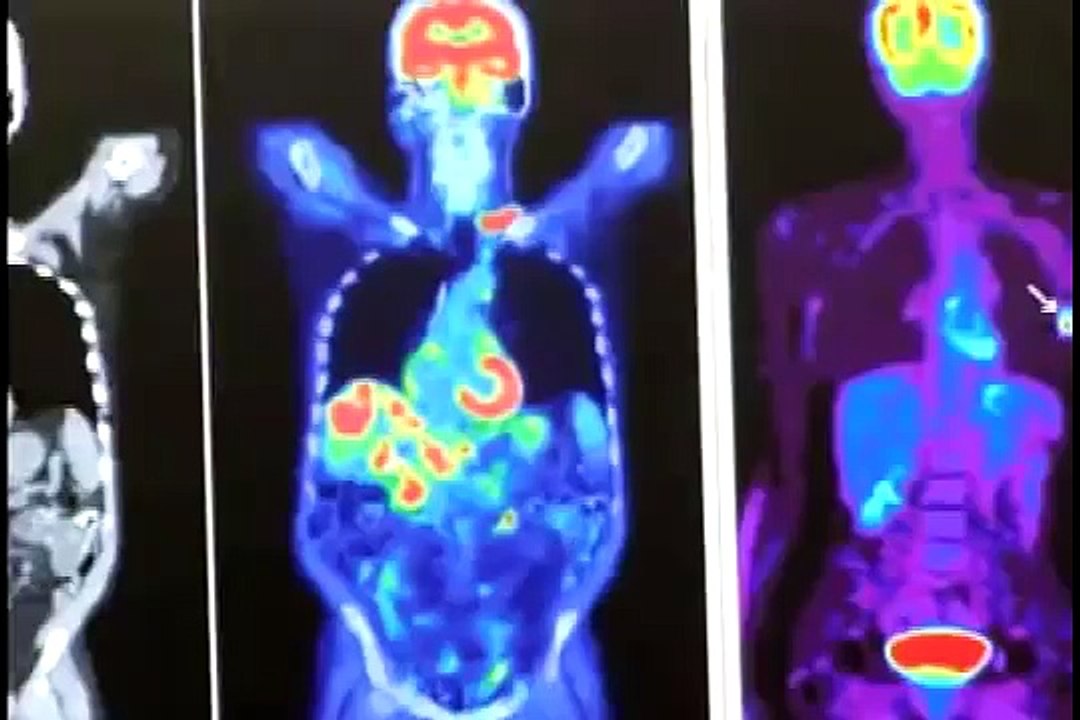 Globo Ciência - O Mundo da Física Quântica 2/2  24/07/2010
