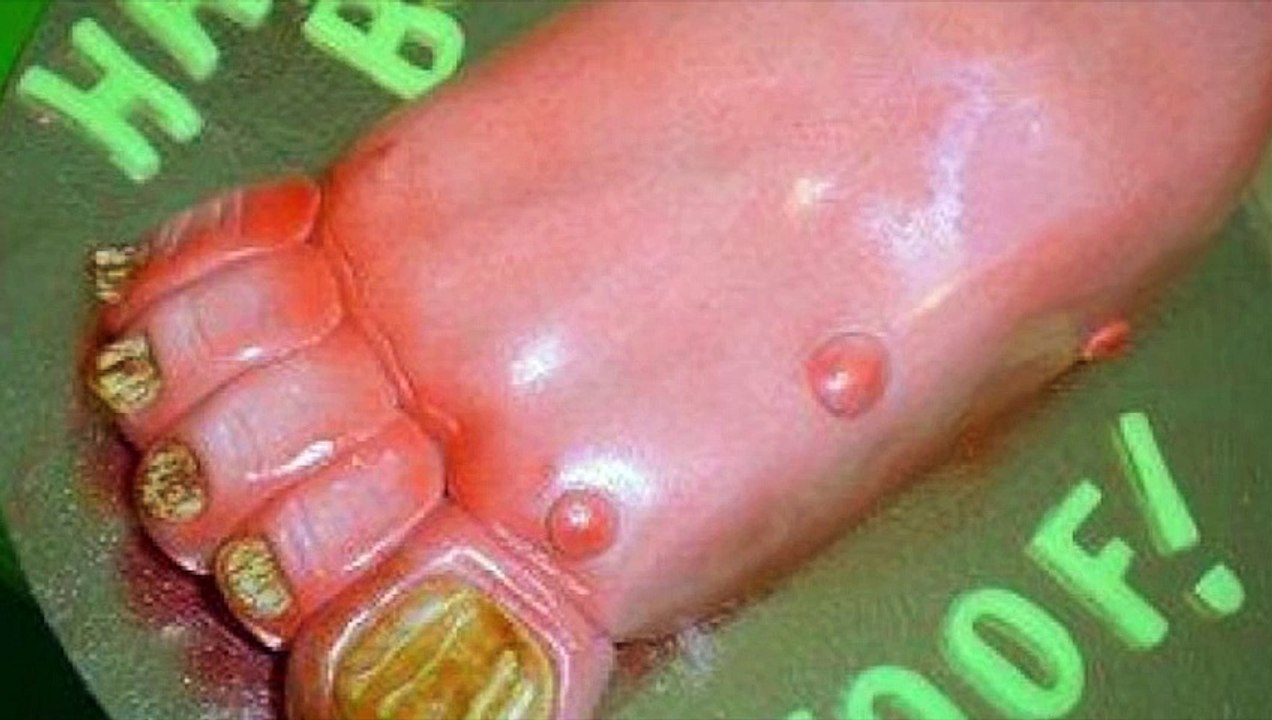 Najgore torte 1. dio