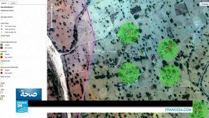 صحة: نجاح أول عملية زراعة يدين لطفل في الولايات المتحدة