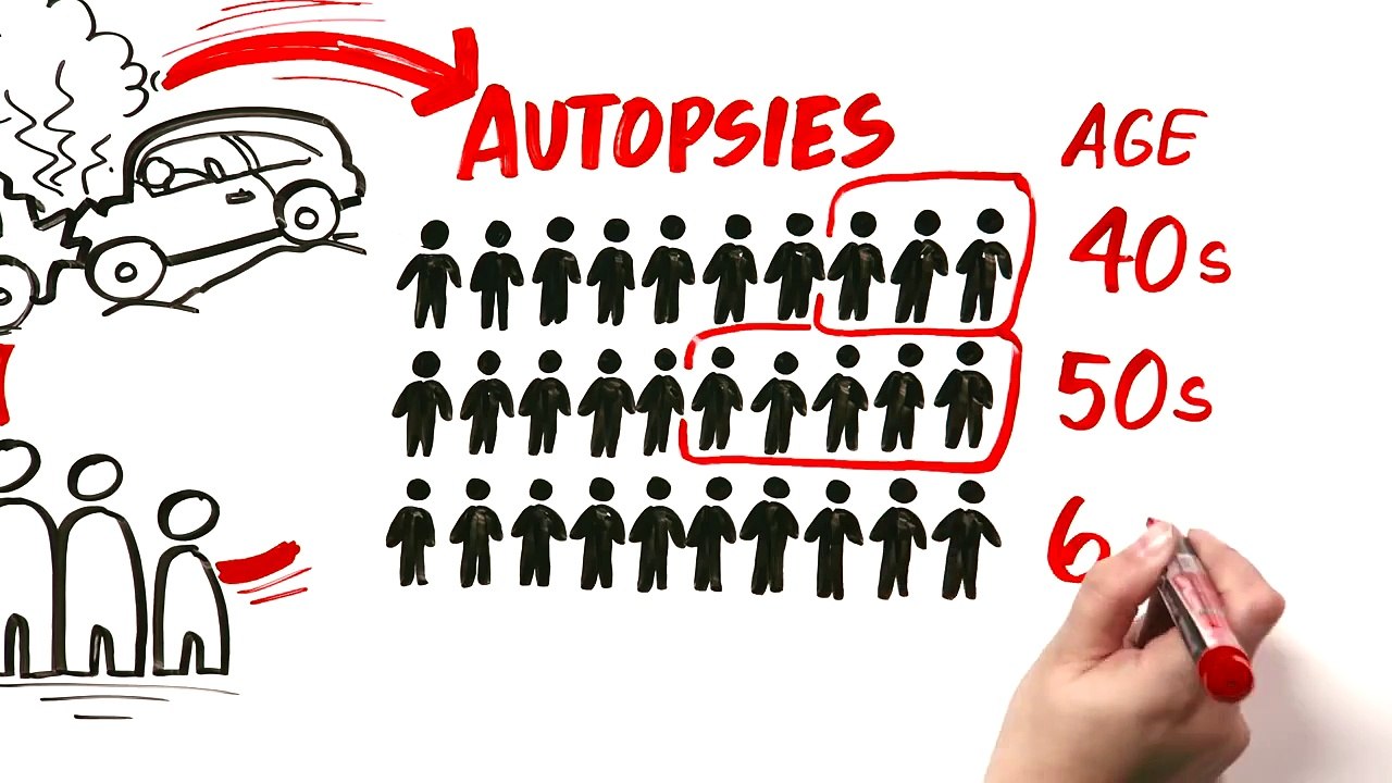 The Prostate Specific Antigen (PSA) Test