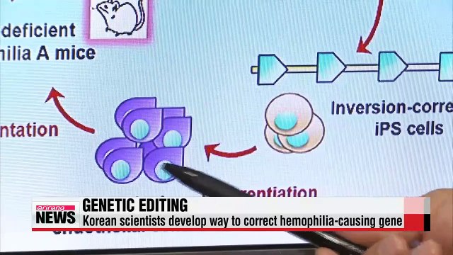 Korean scientists develop way to correct hemophilia-causing gene
