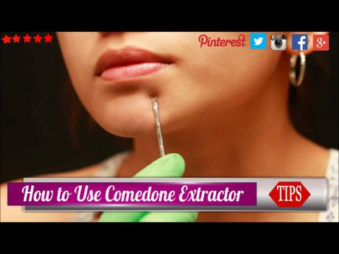 How to Use Comedone Extractor to Remove Blackheads in 8 Easy Steps