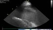Echography of a pleural effusion in a horse Ghent university, Belgium (gent)