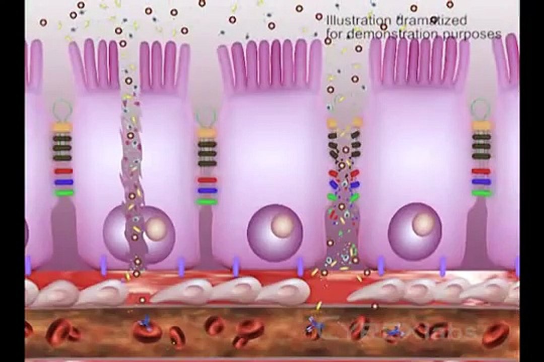 Gut-Brain Connection