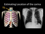 Basic Chest Radiology: ET Tube Position and Complications