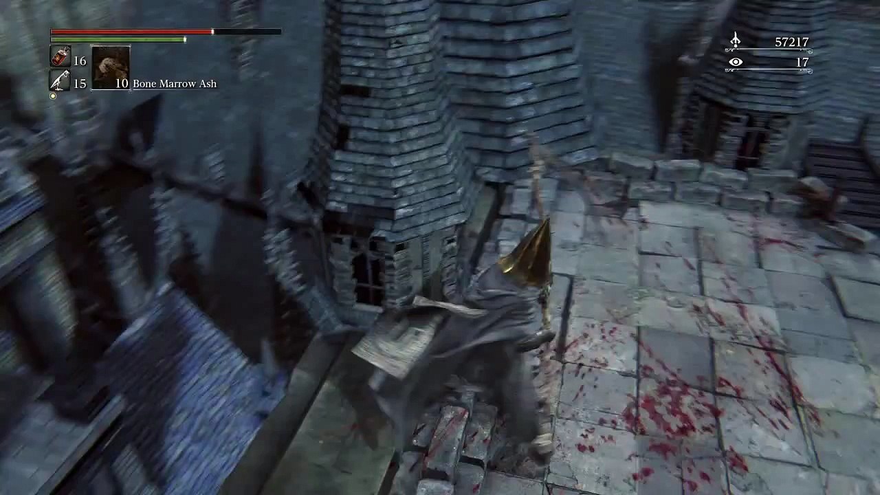 Why wearing cone-shaped metal hats are a bad idea.