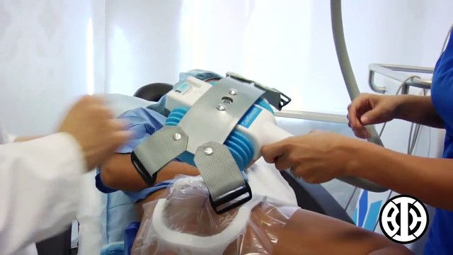 CoolSculpting for outer thigh fat