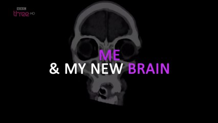 me & my new brain