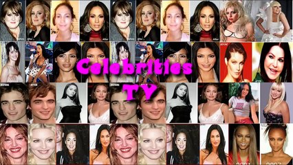 Lana Del Rey Plastic Surgery Before and After