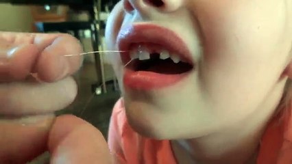 Miniature Dachshund Pulls Loose Tooth With Fishing Line