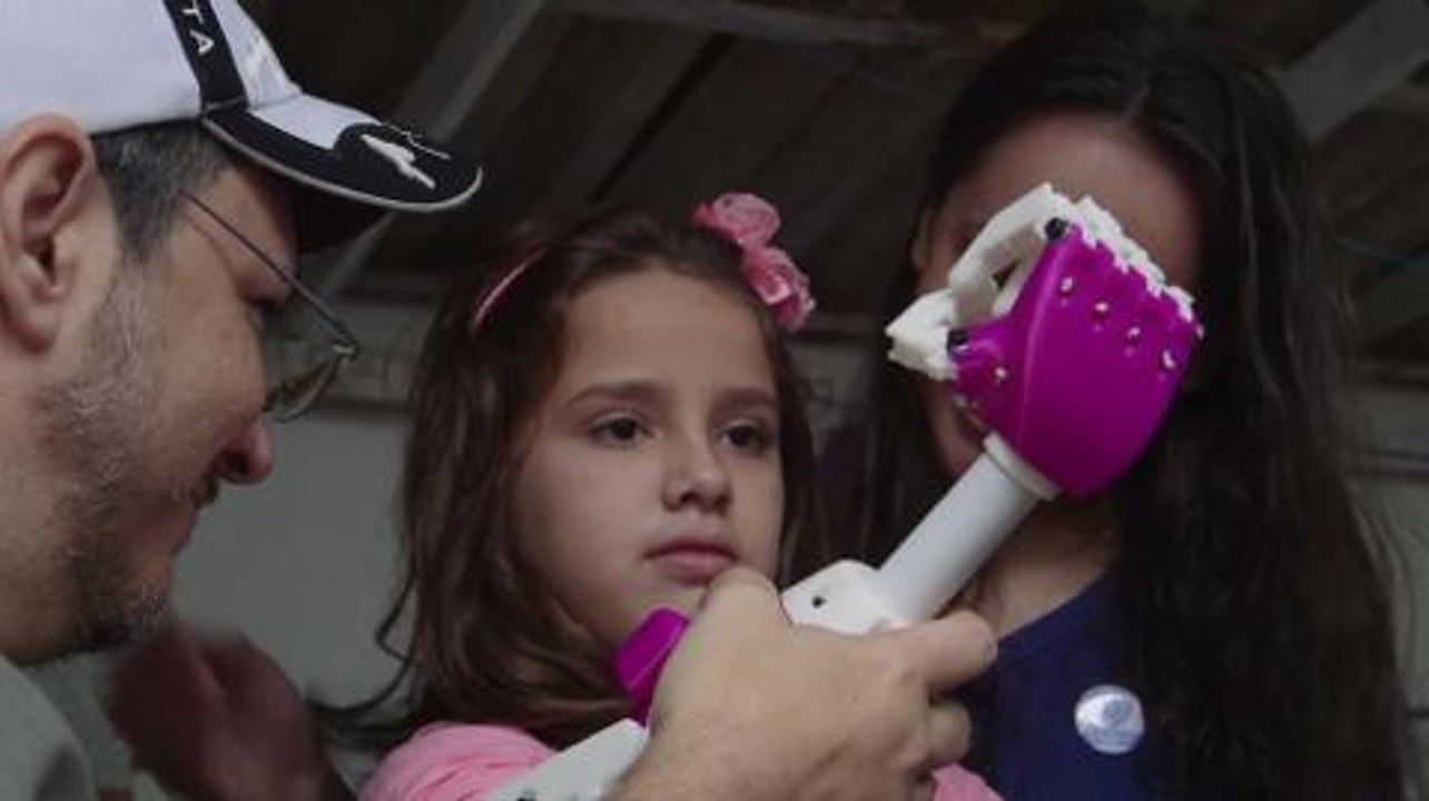 The Cure - 3-D Printed Prosthetics