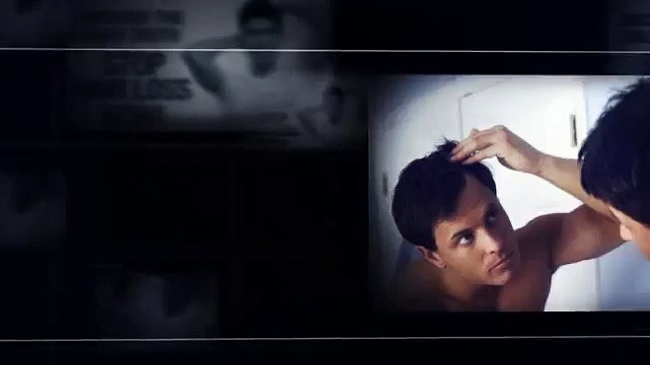 geico commercial - parker solution to hair loss