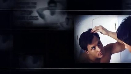 geico commercial - parker solution to hair loss