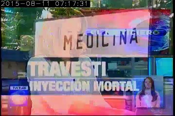 Un estilista falleció en Guayaquil, por inyectarse silicona