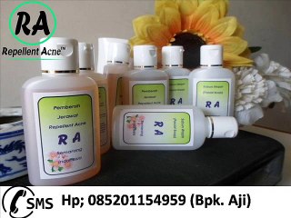 085201154959, Obat Jerawat Untuk Anak