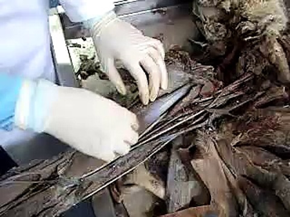 anatomia, musculos del brazo