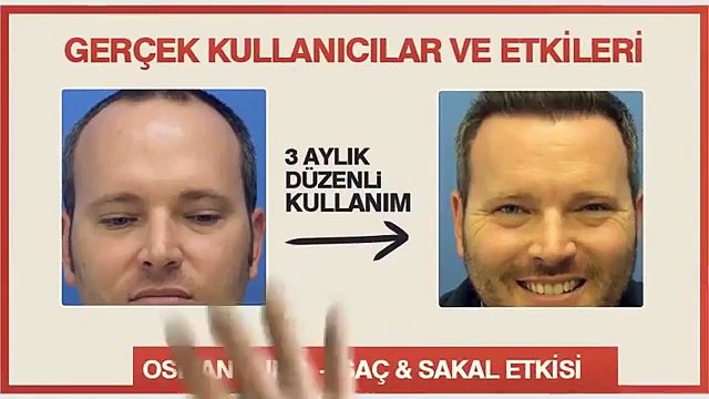 pro care serum,pro care serum nedir,pro care sipariş,pro care yan etkisi var mı,pro care içeriği