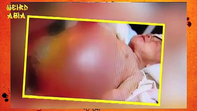 2 Year Old Gives Birth To Own Twin!