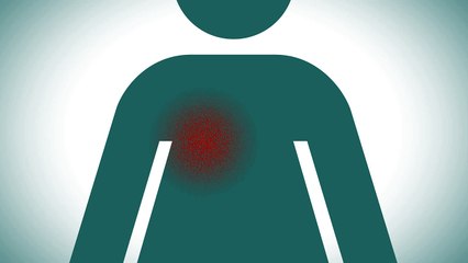 Mepitel Film radiation therapy study 2014