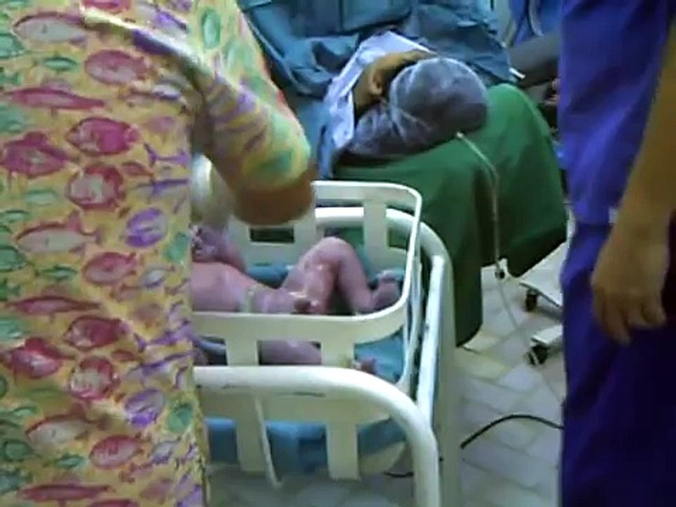 baby coming out of mom's tummy