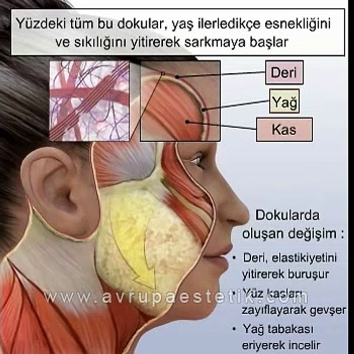 Yüz Estetiği ve Estetik Yüz Germe Ameliyatı Videosu, Op. Dr. Nazmi Bayçın