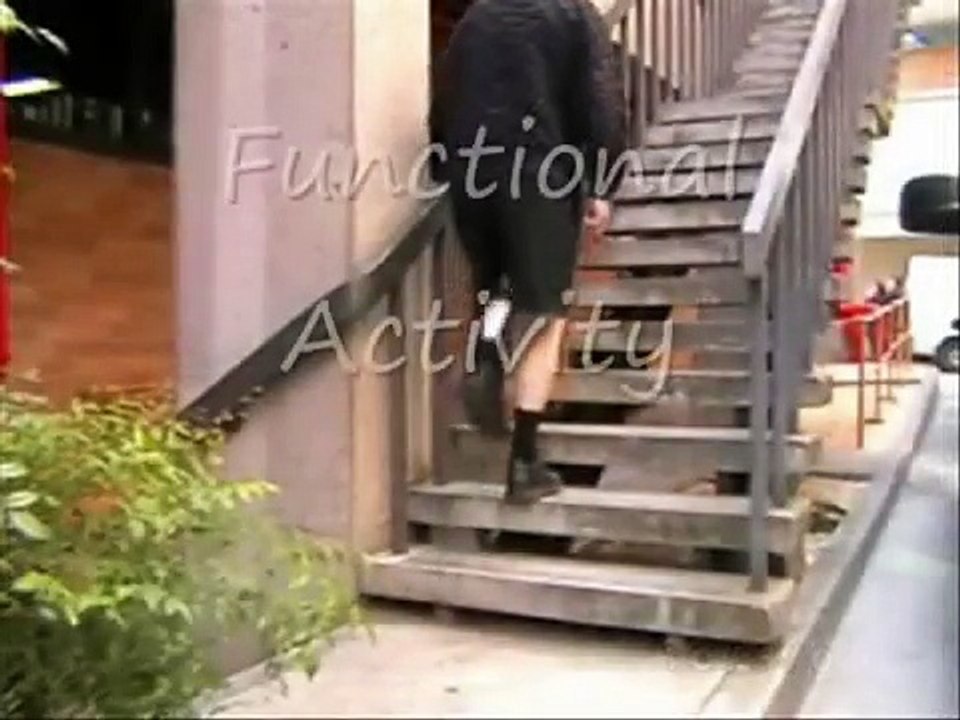 Polio: Stance Control Leg Brace