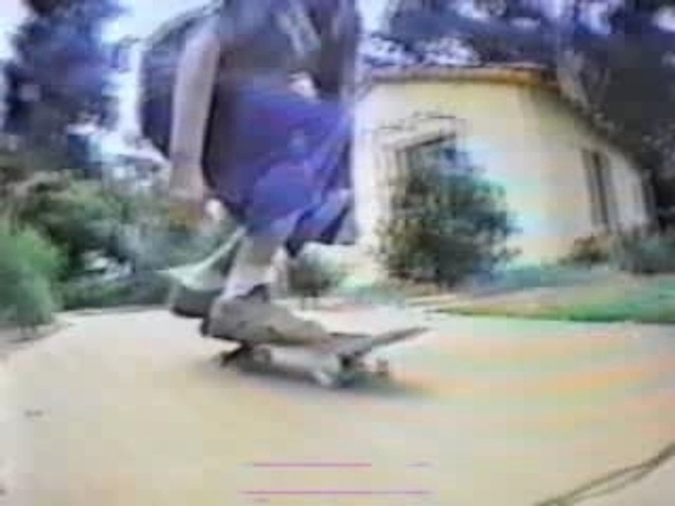 Scateboard accident