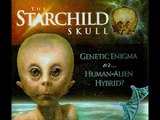 Starchild Skull and Hominoids 2 of 12